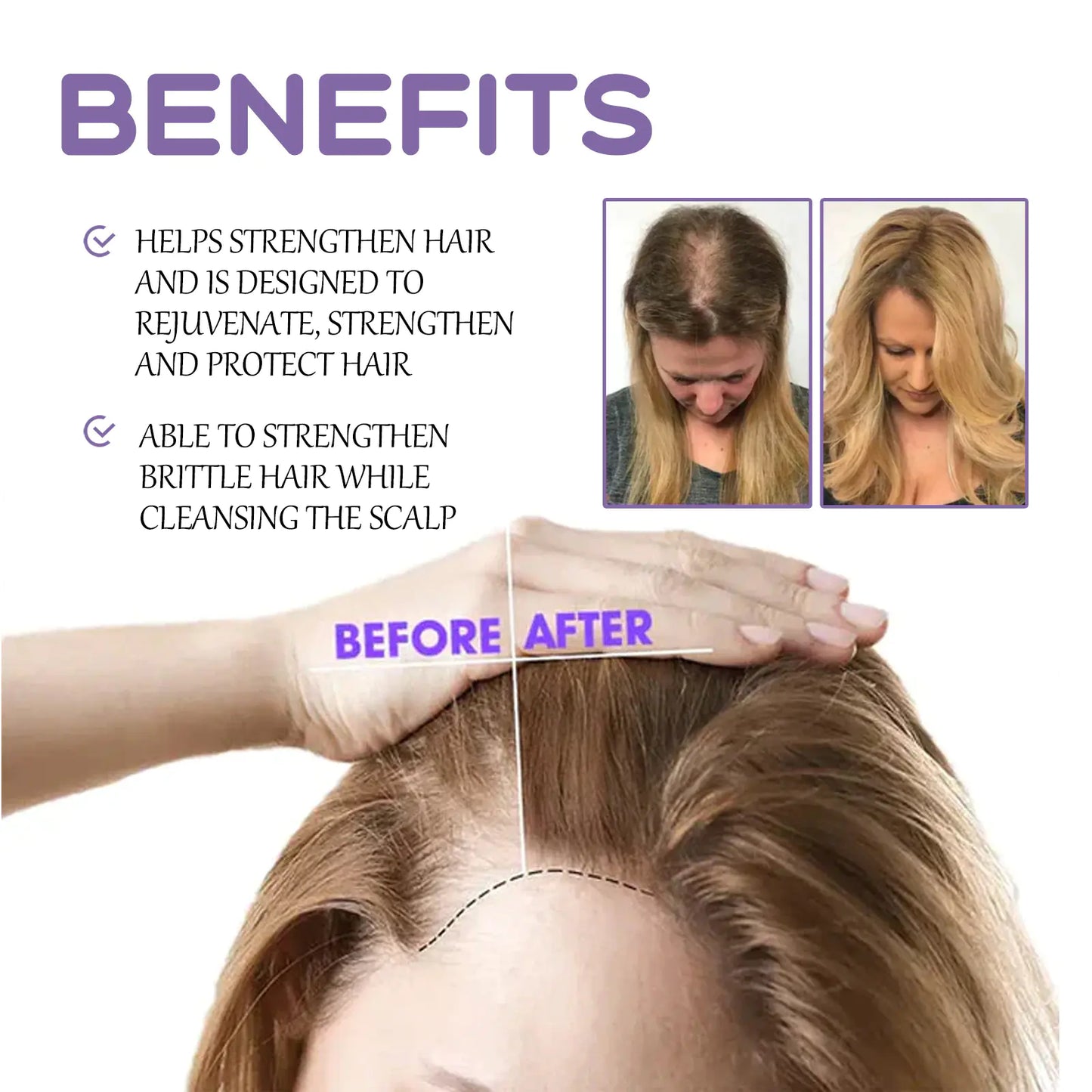 Googeer Hair Follicle Nourishing Serum for Thickening
