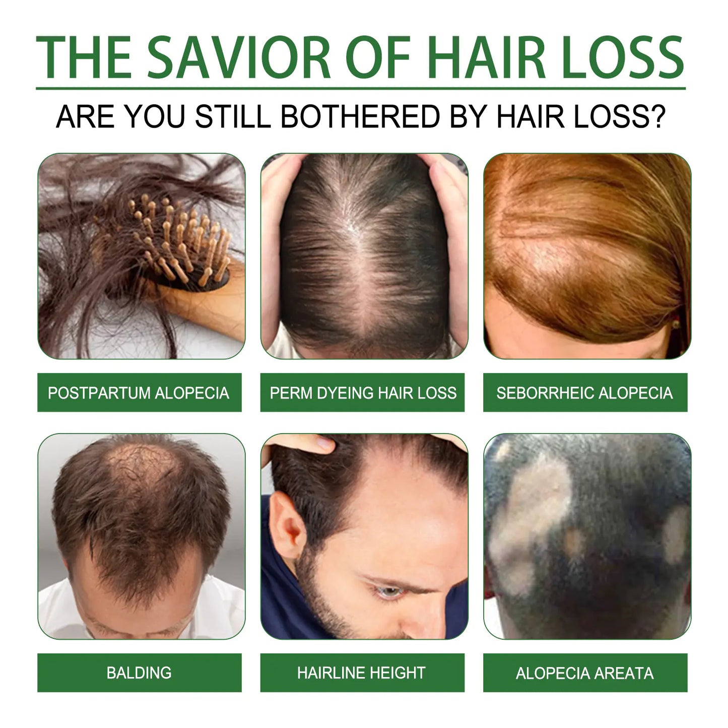 Jaysuing Multi-Effect Rosemary Essential Oil for Hair Care