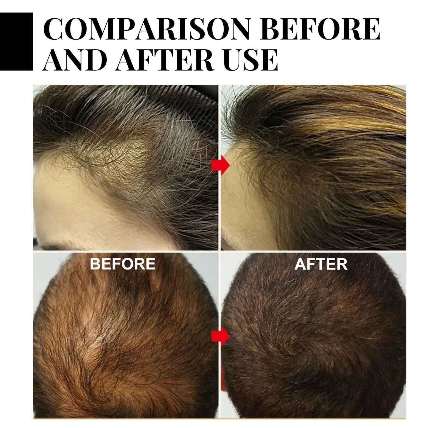 Jaysuing Batana Series Nourishing Hair Care Treatment
